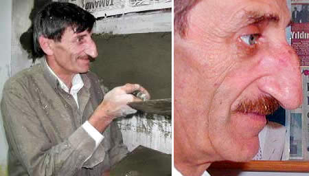 Mehmet Ozyurek World's Longest Nose 4.5 inches